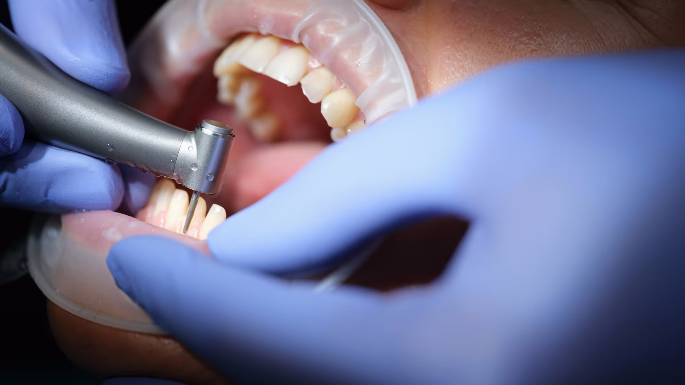Illustration: restorative dentistry