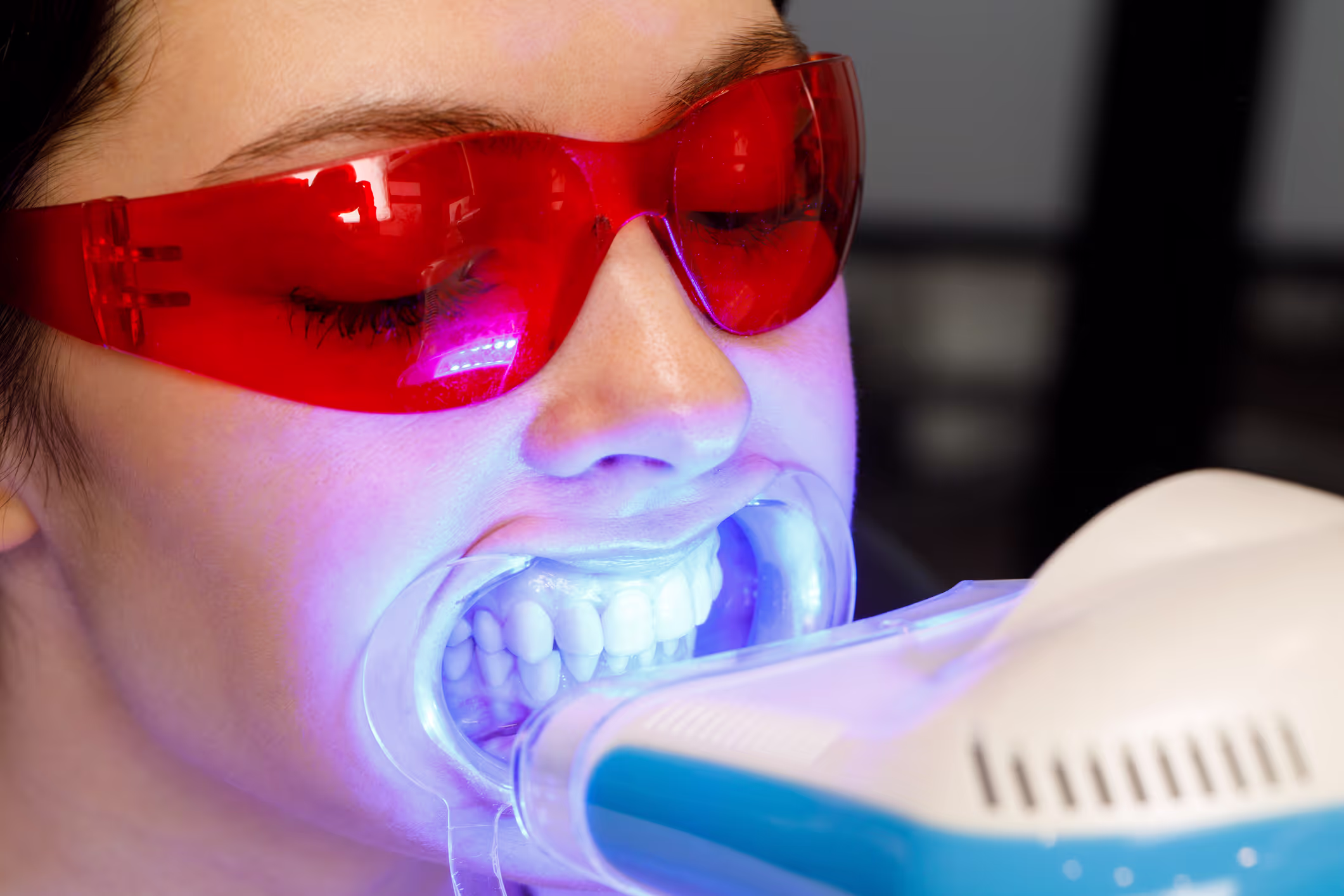 Illustration: Zoom whitening